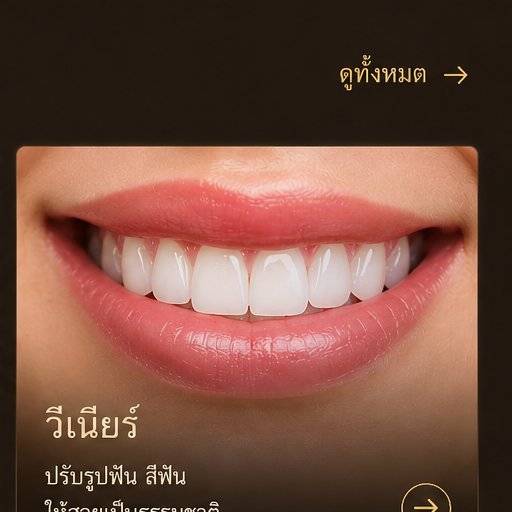 วีเนียร์