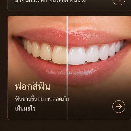 ฟอกสีฟัน